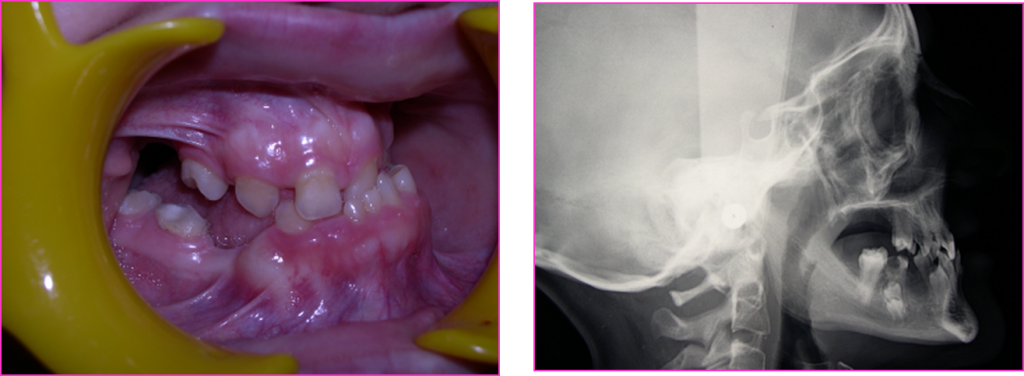 Figure 1 Chirurgie Orthognathique