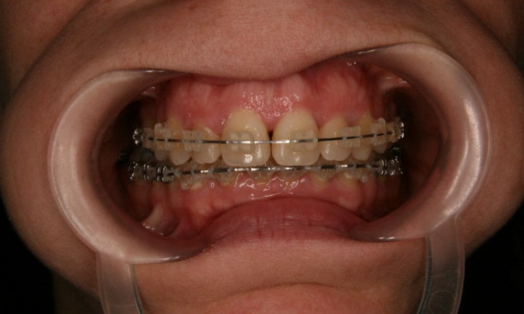Figure 2a