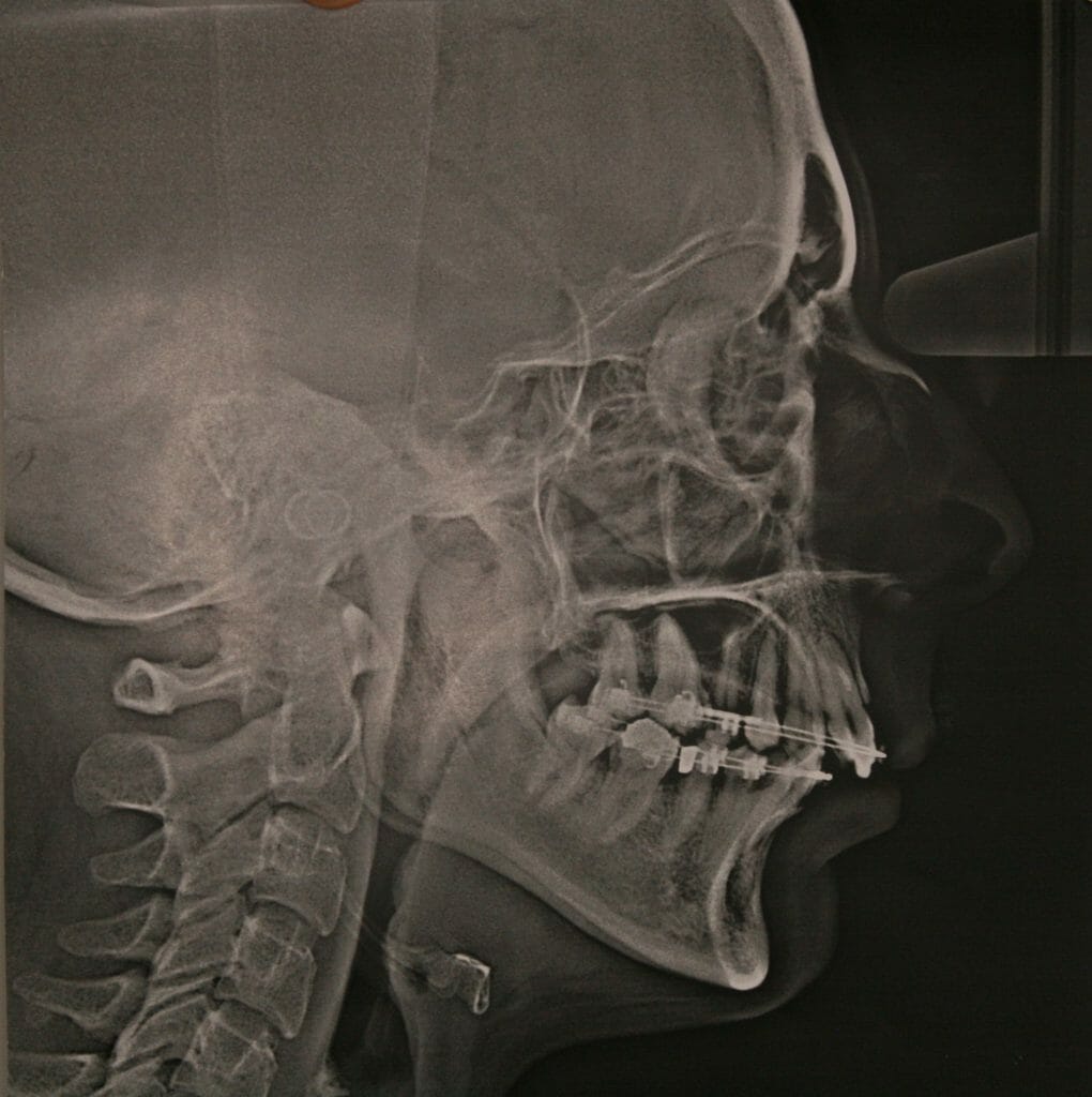 Figure 2b