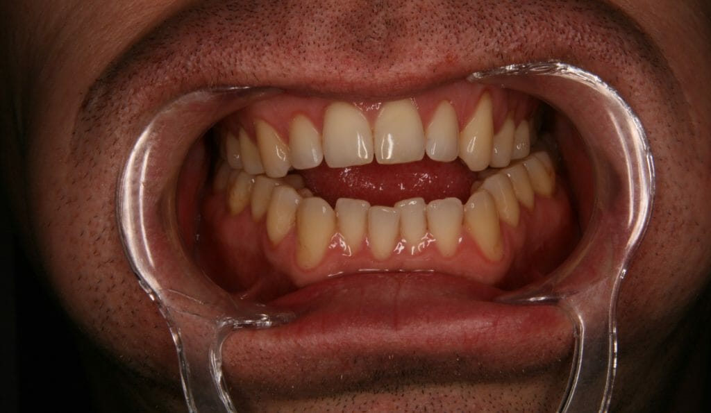 Figure 4a