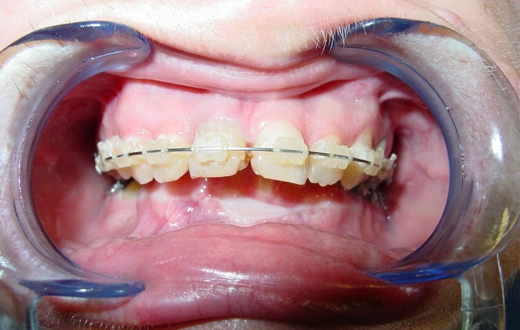 Figure 5a