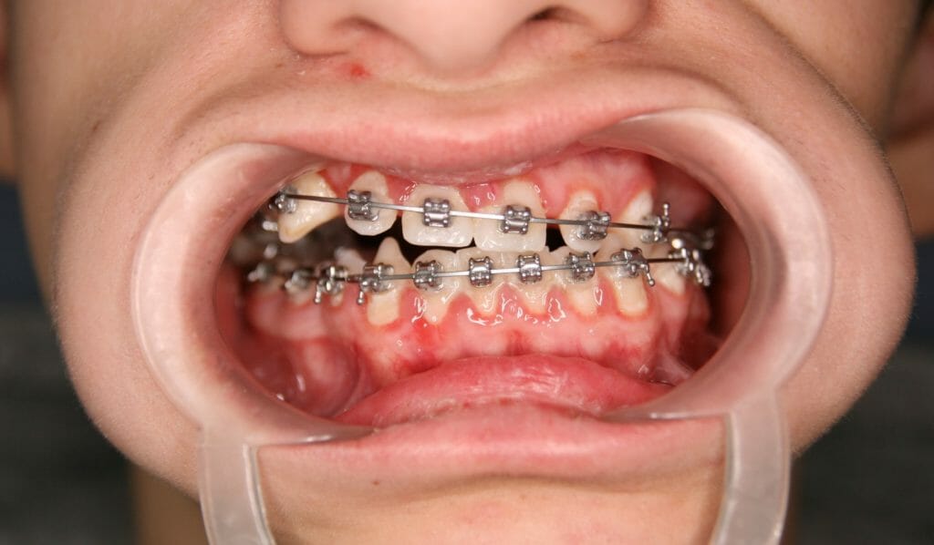 Figure 6a