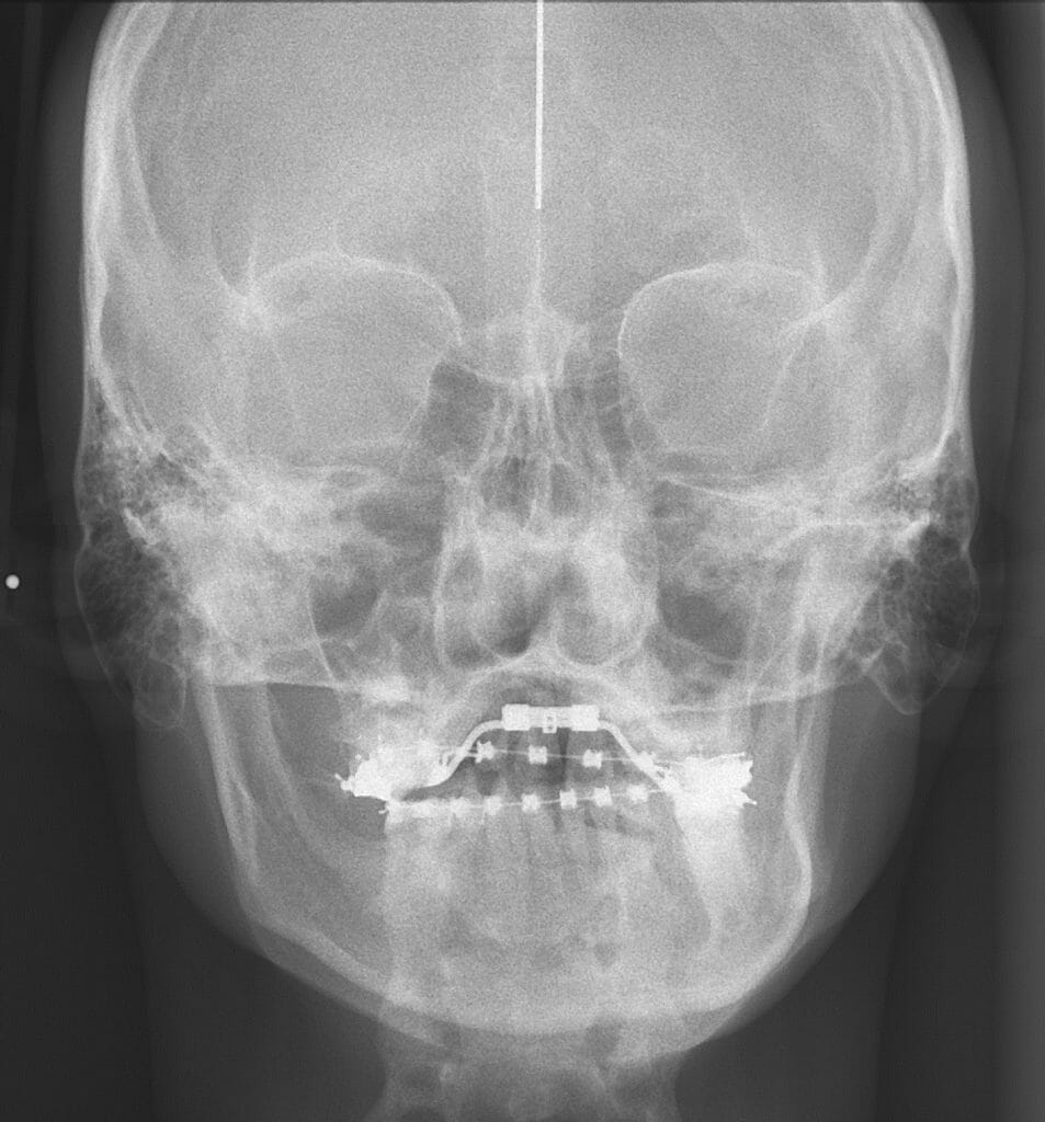 Figure 6b