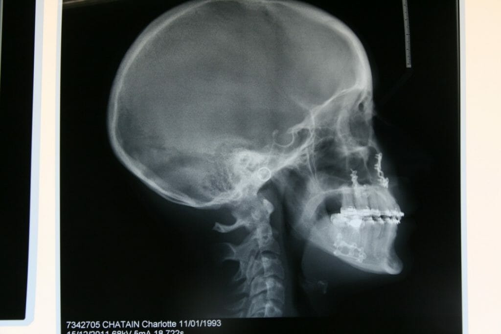 Figure 6 (2)